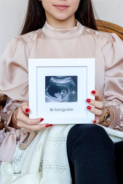 BBM-3001ANNE & BEBEKİlk Fotoğrafım Bebek Ultrason Çerçevesi - Bebek Odası Fotoğraf ve Resim Anı ÇerçevesiFufizu