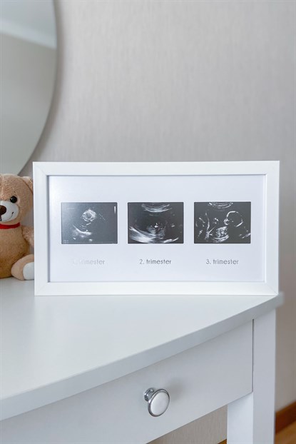 BBM-3004ANNE & BEBEKÜçlü Ultrason Anı Çerçevesi - Gebelikte Bebeğin Gelişimini Üç Trimester Anı Olarak SaklayınFufizu